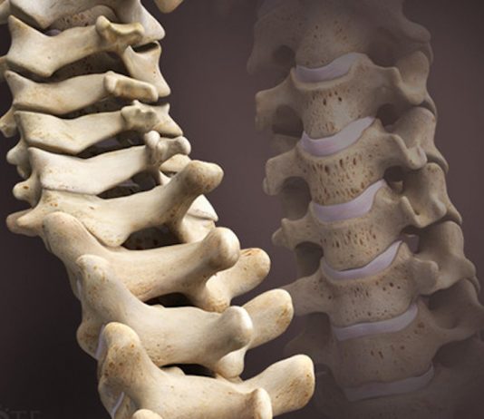 Disco Intervertebrale: Anatomia e Biomeccanica disco intervertebrale