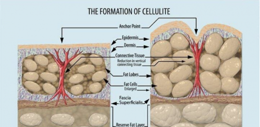 dieta per cellulite