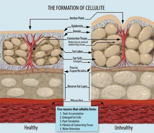 dieta per cellulite